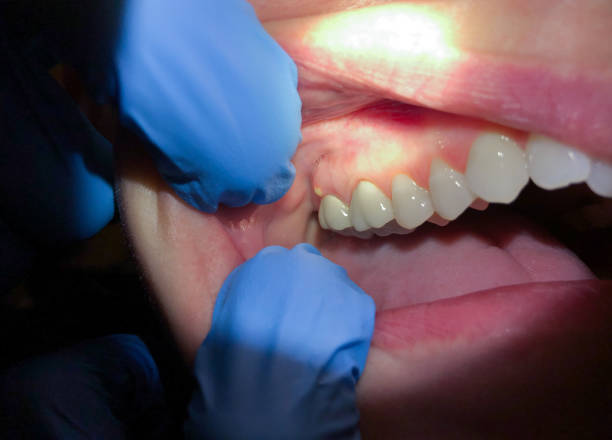 Best Weekend Emergency Dentist in White Oak, TX