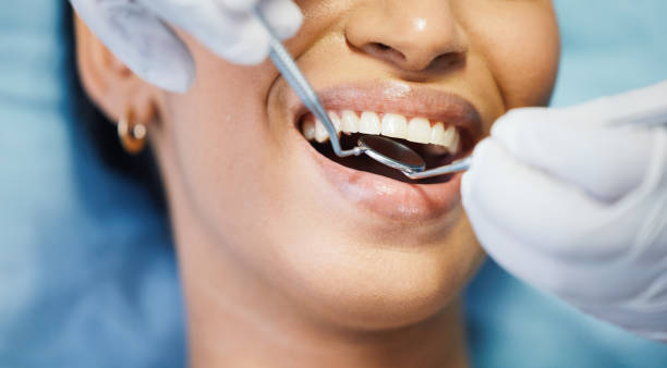 Best After-Hours Dental Trauma Care in White Oak, TX