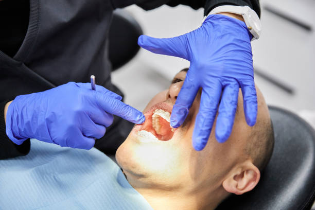 Best Emergency Tooth Extraction in White Oak, TX